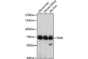 Western blot analysis of extracts of various cell lines, using TNXB antibody (ABIN3016209, ABIN3016210, ABIN3016211 and ABIN6219624) at 1:1000 dilution. (TNXB 抗体  (AA 444-673))
