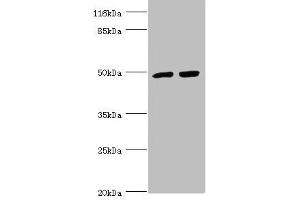 Western blot All lanes: TRIM13 antibody at 1. (TRIM13 抗体  (AA 40-310))