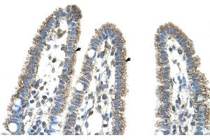 Human Intestine (CPS1 抗体  (Middle Region))