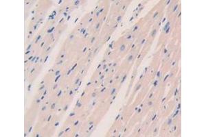 IHC-P analysis of Mouse Tissue, with DAB staining. (PDK1 抗体  (AA 172-399))