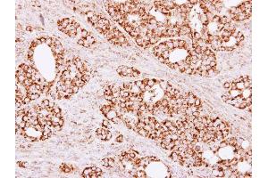 Immunohistochemistry (IHC) image for anti-Citrate Synthase (CS) antibody (ABIN2856769)
