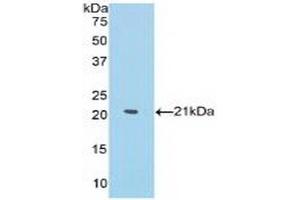 WB of Protein Standard: different control antibodies against Highly purified E. (MMP13 CLIA Kit)