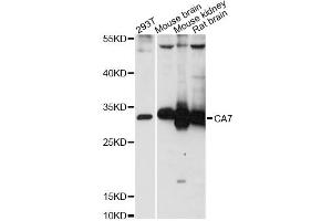 Western blot analysis of extracts of various cell lines, using CA7 antibody (ABIN6292752) at 1:3000 dilution. (CA7 抗体)