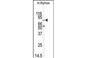 Western blot analysis of anti-EMK Antibody (C-term) (ABIN392538 and ABIN2837987) in mouse thymus tissue lysates (35 μg/lane). (MARK2 抗体  (C-Term))