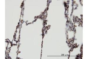 Image no. 1 for anti-XPA Binding Protein 2 (XAB2) (AA 1-856) antibody (ABIN599281) (XAB2 抗体  (AA 1-856))