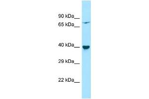 Host: Rabbit Target Name: PPM1L Sample Type: HepG2 Whole Cell lysates Antibody Dilution: 1. (PPM1L 抗体  (Middle Region))
