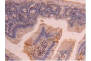 Detection of CPB2 in Mouse Intestine Tissue using Polyclonal Antibody to Carboxypeptidase B2 (CPB2) (CPB2 抗体  (AA 187-327))
