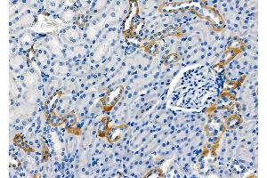 ABIN6264573 and ABIN6278624 at 1/100 staining Rat kidney tissue by IHC-P. (RAB35 抗体  (Internal Region))