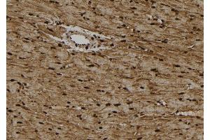 ABIN6262813 and ABIN6274021 at 1/100 staining Rat heart tissue by IHC-P. (KIFC1 抗体  (Internal Region))