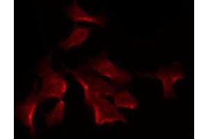 ABIN6275617 staining HuvEc by IF/ICC. (SYT13 抗体  (Internal Region))