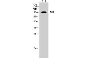Western Blotting (WB) image for anti-Solute Carrier Family 28 (Sodium-Coupled Nucleoside Transporter), Member 2 (SLC28A2) (Internal Region) antibody (ABIN3183992)
