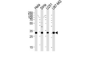 Western Blotting (WB) image for anti-Homeobox B2 (HOXB2) antibody (ABIN3004768) (HOXB2 抗体)