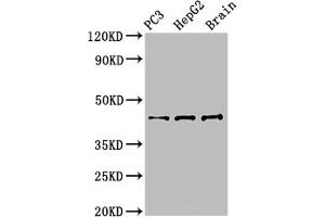 Western Blot Positive WB detected in: PC-3 whole cell lysate, HepG2 whole cell lysate, Mouse brain tissue All lanes: STAC antibody at 3 μg/mL Secondary Goat polyclonal to rabbit IgG at 1/50000 dilution Predicted band size: 45 kDa Observed band size: 45 kDa (STAC 抗体  (AA 1-119))