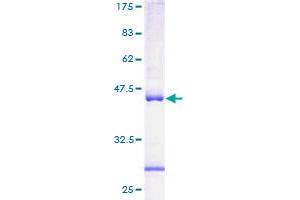 ACAT1 Protein (AA 16-162) (GST tag)