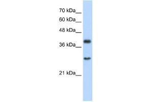 WB Suggested Anti-WDR39 Antibody Titration:  2. (CIAO1 抗体  (C-Term))