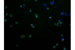 Immunofluorescence staining of MCF-7 cells with ABIN7139980 at 1:100, counter-stained with DAPI. (OR2M2 抗体  (AA 259-273))