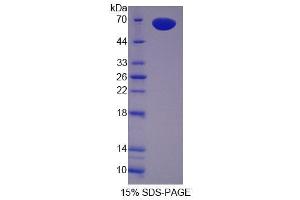 SDS-PAGE analysis of Mouse Pregnancy Zone Protein. (PZP 蛋白)
