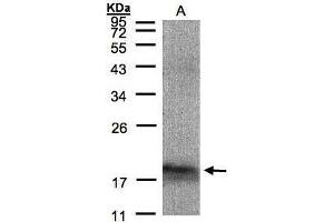 WB Image Sample(30 μg of whole cell lysate) A:293T 12% SDS PAGE antibody diluted at 1:1500 (MANF 抗体)