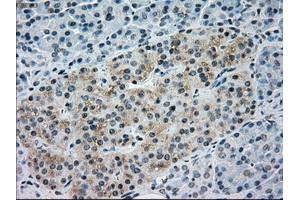 Immunohistochemical staining of paraffin-embedded Ovary tissue using anti-NRBP1mouse monoclonal antibody. (NRBP1 抗体)