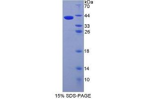 SDS-PAGE (SDS) image for Adhesion Molecule with Ig-Like Domain 1 (AMIGO1) (AA 28-372) protein (His tag) (ABIN6237669)