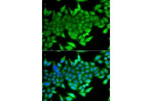 Immunofluorescence analysis of A549 cells using TTF2 antibody (ABIN5975177). (TTF2 抗体)