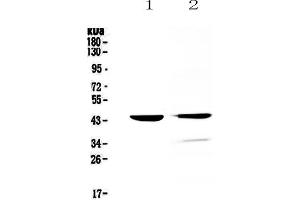 Western blot analysis of Cathepsin D using anti-Cathepsin D antibody . (Cathepsin D 抗体  (AA 161-358))