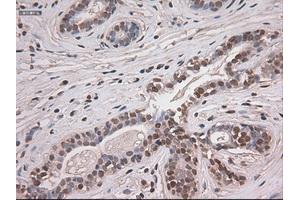 Immunohistochemical staining of paraffin-embedded breast tissue using anti-NOTCH1 mouse monoclonal antibody. (Notch1 抗体  (AA 2300-2556))