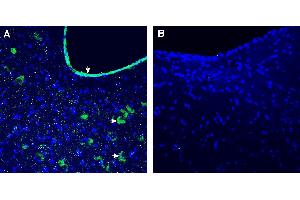 Expression of GFRAL in rat nucleus of the solitary tract. (GFRAL 抗体  (Extracellular))