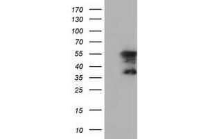 HEK293T cells were transfected with the pCMV6-ENTRY control (Left lane) or pCMV6-ENTRY DYNC1LI1 (Right lane) cDNA for 48 hrs and lysed. (DYNC1LI1 抗体)