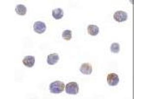 Immunocytochemical staining of DRAK2 in Jurkat cells with DRAK2 antibody at 10μg/ml. (DRAK2 抗体  (AA 351-365))