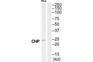 Western Blotting (WB) image for anti-Calcium Binding Protein P22 (CHP) (N-Term) antibody (ABIN1850961) (CHP 抗体  (N-Term))