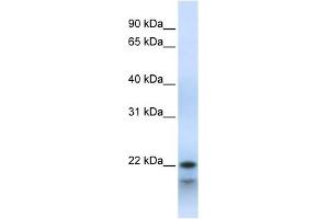 POLR3H antibody used at 1 ug/ml to detect target protein. (POLR3H 抗体  (Middle Region))