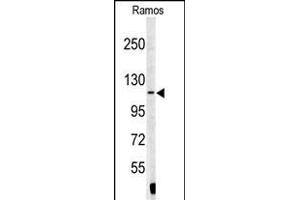 Western Blotting (WB) image for anti-Exportin, tRNA (Nuclear Export Receptor For TRNAs) (XPOT) (AA 137-166), (N-Term) antibody (ABIN391952)