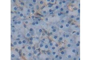 IHC-P analysis of Human Tissue, with DAB staining. (IL13RA2 抗体  (AA 238-334))
