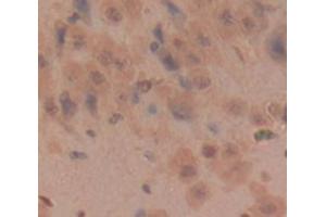 Immunohistochemistry (IHC) image for anti-Kallikrein 6 (KLK6) (AA 26-261) antibody (ABIN1859554)