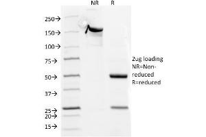SDS-PAGE Analysis Purified CD5 Mouse Monoclonal Antibody (CD5/54/F6). (CD5 抗体)
