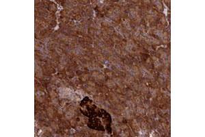 Immunohistochemical staining of human pancreas with DDX60L polyclonal antibody  shows strong cytoplasmic positivity in exocrine glandular cells at 1:50-1:200 dilution. (DDX60L 抗体)
