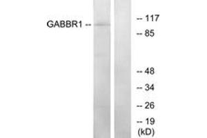 Western blot analysis of extracts from K562 cells, using GABBR1 Antibody. (GABBR1 抗体  (AA 891-940))