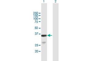 Western Blot analysis of OLIG2 expression in transfected 293T cell line by OLIG2 MaxPab polyclonal antibody. (OLIG2 抗体  (AA 1-323))