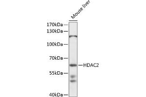 Western blot analysis of extracts of mouse liver, using HD antibody  at 1:1000 dilution. (HDAC2 抗体  (AA 429-488))