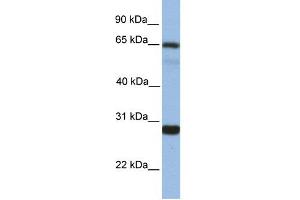 WB Suggested Anti-MED4 Antibody Titration:  1 ug/ml  Positive Control:  Fetal liver cell lysate (MED4 抗体  (Middle Region))