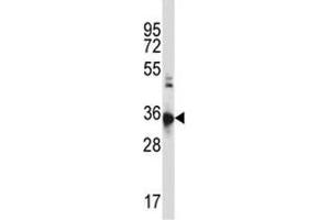 CCR10 antibody western blot analysis in HL-60 lysate (CCR10 抗体  (AA 1-30))