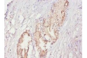 Immunohistochemistry of paraffin-embedded human prostate tissue using ABIN7164895 at dilution of 1:20 (ACPP 抗体  (AA 38-386))