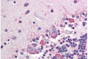 Human Brain, Cerebellum (formalin-fixed, paraffin-embedded) stained with ALPP antibody ABIN296659 at 10 ug/ml followed by biotinylated anti-mouse IgG secondary antibody ABIN481714, alkaline phosphatase-streptavidin and chromogen. (PLAP 抗体)