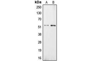 Western blot analysis of Carboxypeptidase E expression in NIH3T3 (A), PC12 (B) whole cell lysates. (CPE 抗体  (Center))