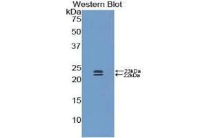 Western blot analysis of the recombinant protein. (BMP1 抗体  (AA 856-982))