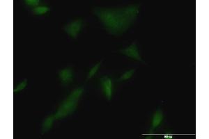 Immunofluorescence of monoclonal antibody to KLK3 on A-549 cell. (Prostate Specific Antigen 抗体  (AA 1-261))