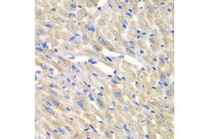 Immunohistochemistry of paraffin-embedded mouse heart using CARS antibody at dilution of 1:100 (x40 lens). (CARS 抗体)