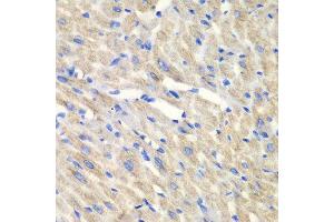 Immunohistochemistry of paraffin-embedded mouse heart using CARS antibody at dilution of 1:100 (x40 lens).