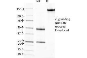 SDS-PAGE Analysis Purified RBP1 Mouse Monoclonal Antibody (G4E4). (RBP4 抗体)